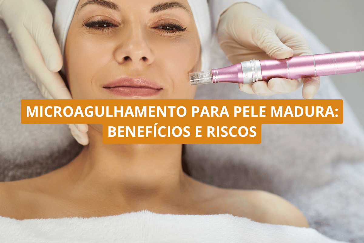 Microagulhamento para pele madura_ benefícios e riscos