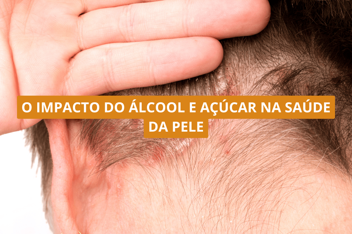 O impacto do álcool e açúcar na saúde da pele