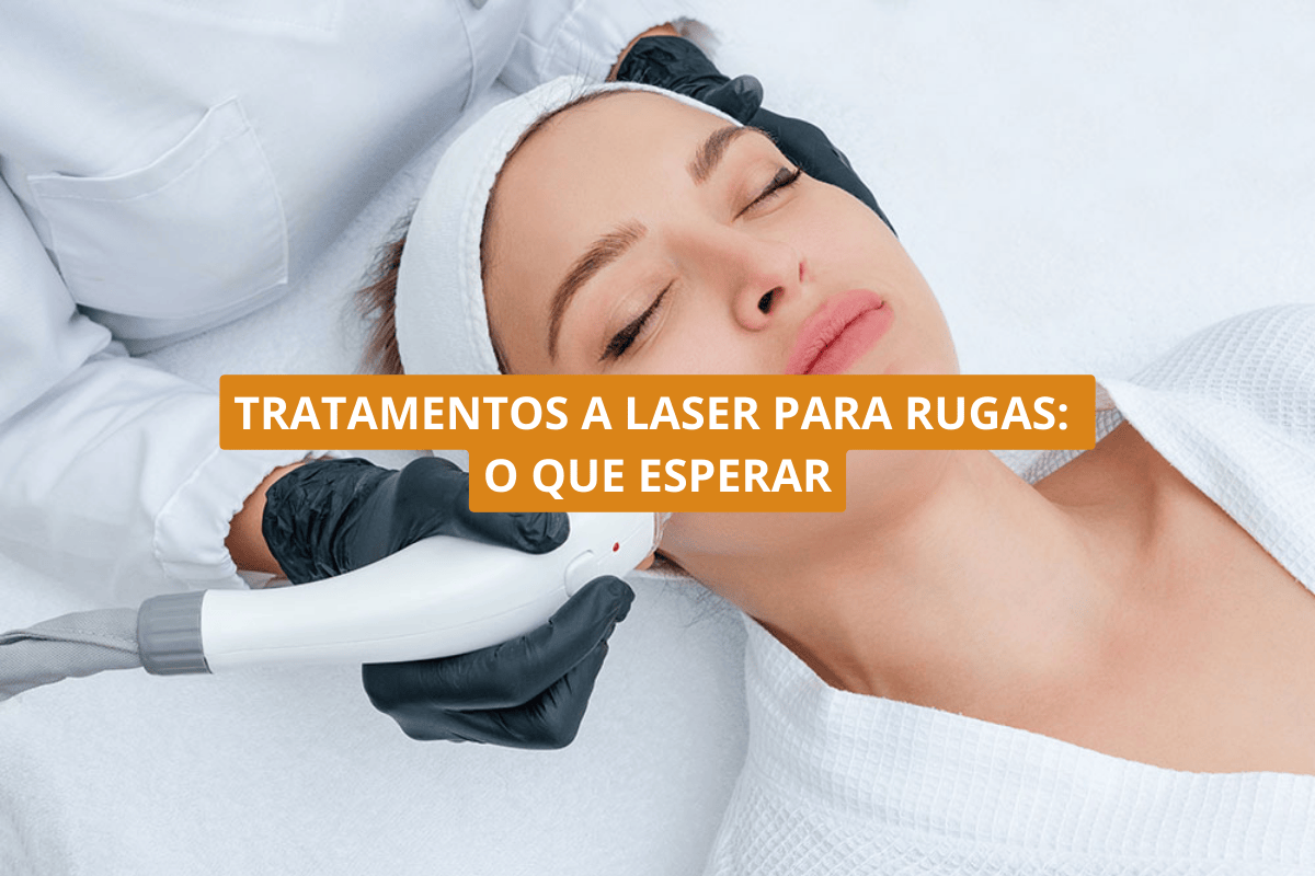 Tratamentos a laser para rugas: o que esperar