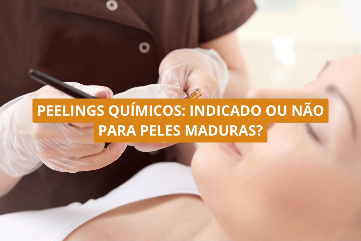 Peelings químicos_ indicado ou não para peles maduras